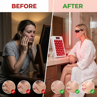 Red Light Therapy Panel 5 Wavelength 60 Dual Chip Leds 630+660+810+830+850Nm Red and near Infrared Lamp Therapy Device 100W with Timer & Stand for Body Pain Relief Face Skin Health Sleep White — Before & After
